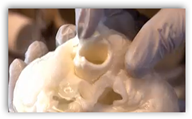 Replacing And Growing Body Parts– Scaffolds Revealed With Regenerative ...